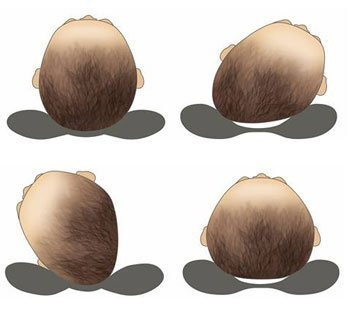 Kuber Industries Baby Head Shaping Detachable Cotton Mustered Seeds Neck Support Pillow (Assorted)